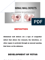 Abdominal Wall Defects