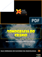 PDF-SLIDES-AULA-1-TC-DE-CRANIO-EMERGÊNCIAS-NEURORRADIOLÓGICAS_compressed