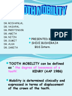 Guided Tooth Mobility Assessment and Treatment Options