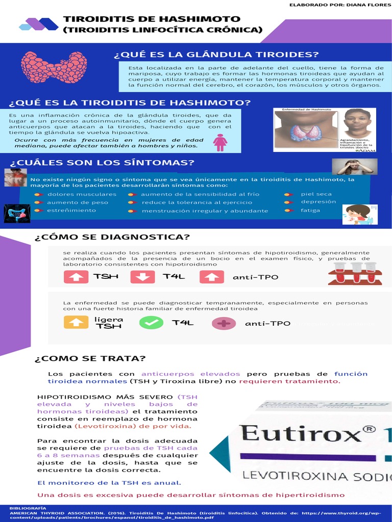 Tiroiditis de Hashimoto | PDF | Tiroides | Hipotiroidismo