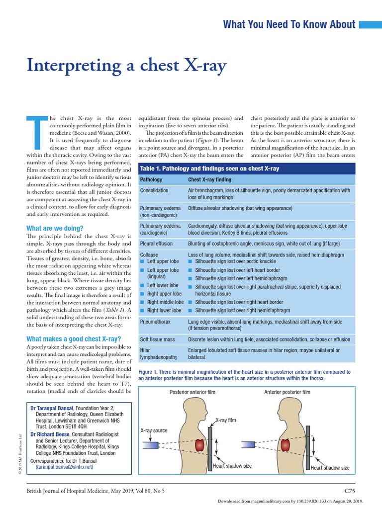Interpreting A Chest XRay PDF Lung Thorax
