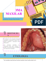 Osteoma Maxilar