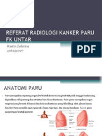 Referat Radiologi Kanker Paru