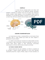 Lesiones Encefalicas y de Los Pares Craneales