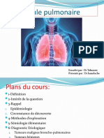 Nodule Pulmonaire