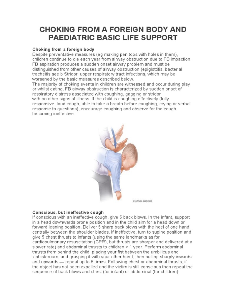 Choking From A Foreign Body and Paediatric Basic Life Support PDF