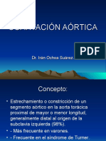 Coartación Aórtica