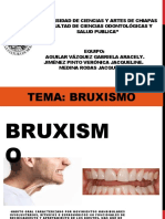 Bruxismo: causas, tipos y tratamiento