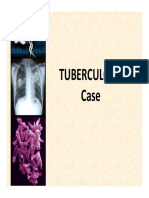 11lec Facing The Challenges of TB