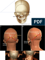 Ultrasound Guided Occipital Nerve Block Injection Technique