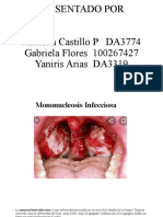 Mononucleosis Infecciosa