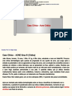 Caso Clínico - Acne Grau III (Cística
