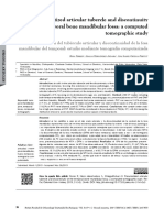 Pneumatized Articular Tubercle and Discontinuity of The Temporal Bone Mandibular Fossa: A Computed Tomographic Study