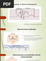 Como Interpretar Un Electrocardiograma