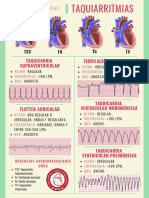 5caracteristicas de Las Taquiarritmias