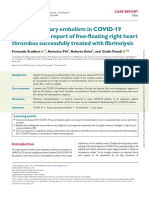 Fibrinolysis in Covid - 19 Patients With Pulmonary Embolism