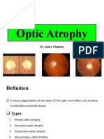 Optic Nerve Diseases II - Audio