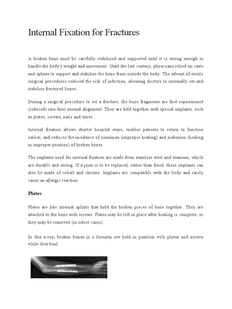 Internal Fixation Devices Explained | PDF | Vertebral Column | Dental ...