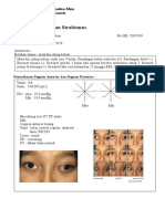 Strabismus