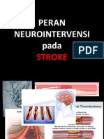 Peranan Neurointervensi