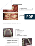 ANALISIS INTRABUCAL