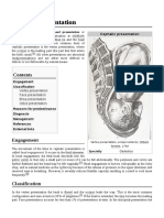 Cephalic Presentation