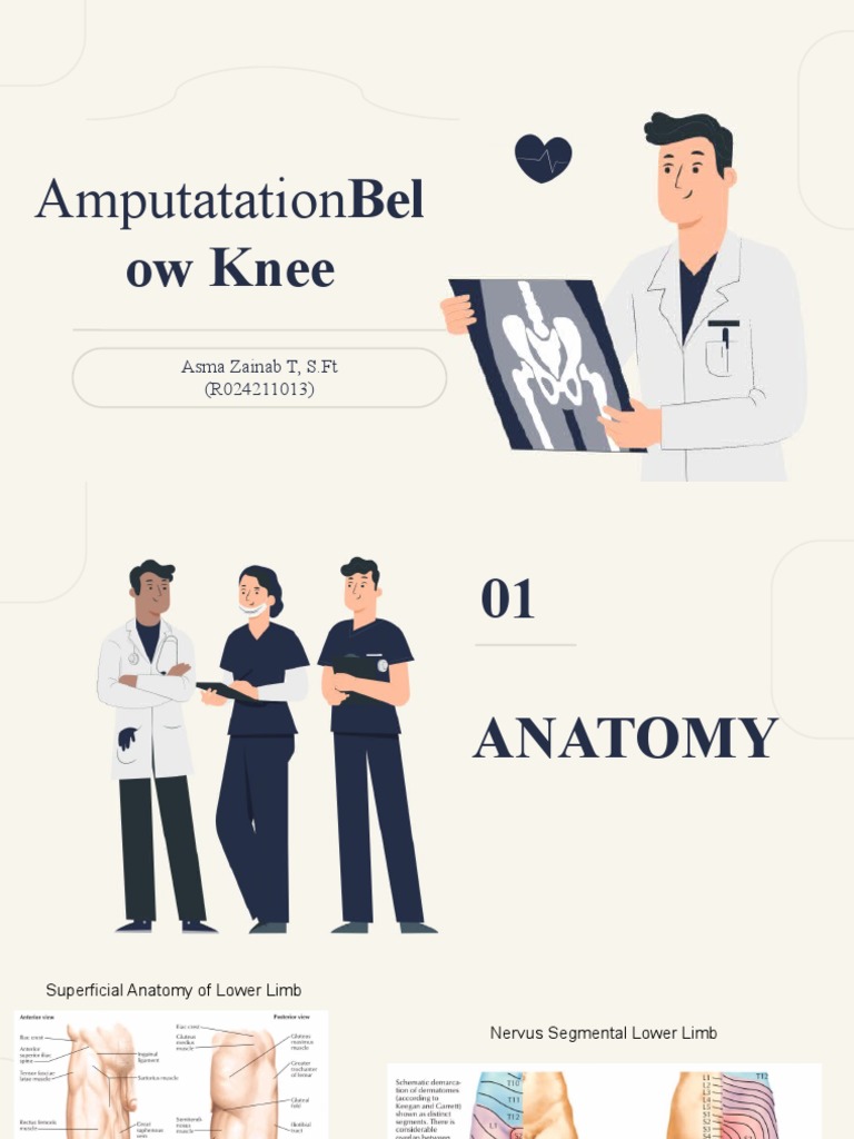Below Knee Amputation Overview | PDF | Planets | Jupiter