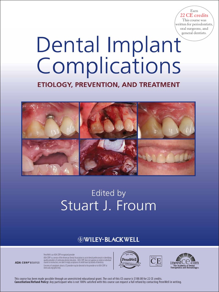 22 CE Credits PDF Dental Implant Periodontology