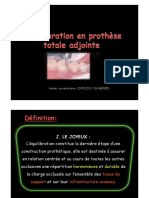 Equilibration Occlusale