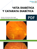 Retinopatia Diabetica y Catarata