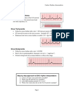 EKG_Rhythms2