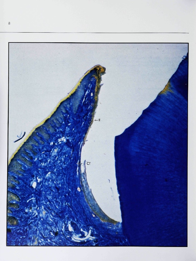 Rotary Gingival Curettage PDF Periodontology Mouth