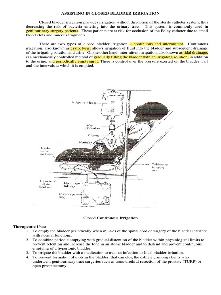 Combine Bladder Irrigation Post Mortem Special Mouth PDF Urination