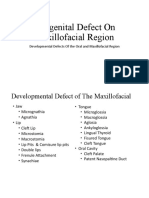 Congenital Defect On Maxillofacial Region: Developmental Defects of The Oral and Maxillofacial Region