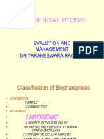 Congenital Ptosis: Evalution and Management DR - Tarakeswara Rao - Ms