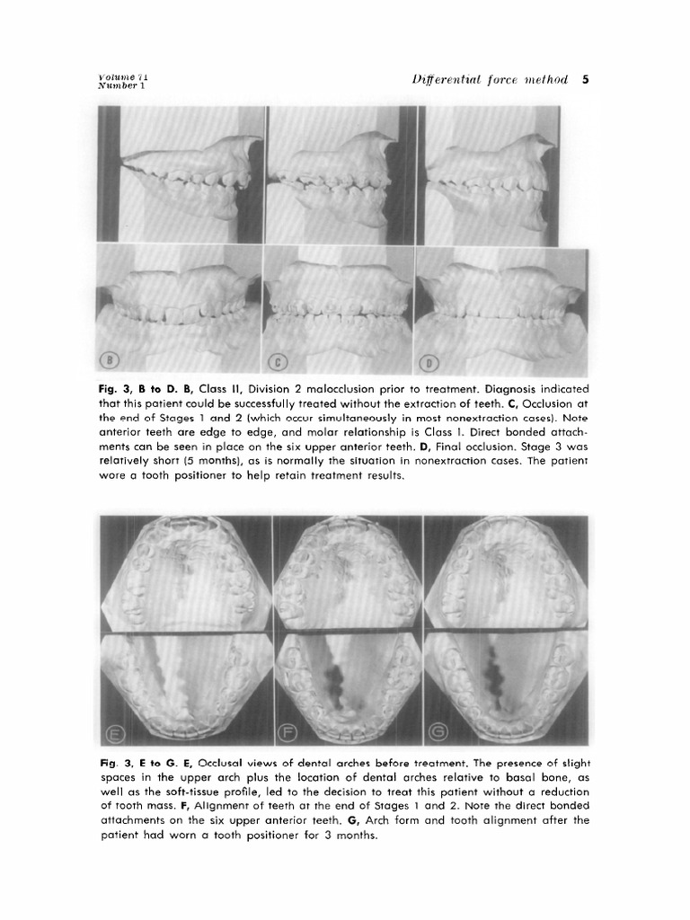Differential FOrce Method of Orthodontic Treatment (1977) (Dragged) 3