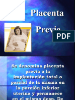 Placenta Previa