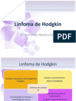 Linfoma de Hodgkin y No Hodgkin