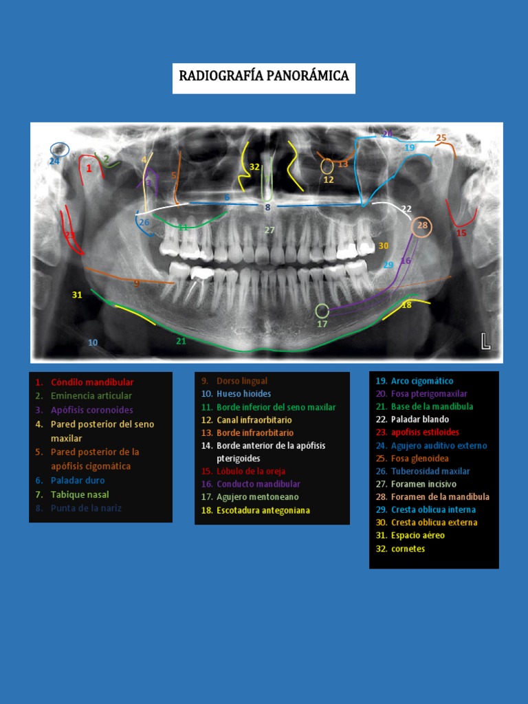 Anatomia de La Radiografia Panoramica PDF Sistema