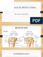 Fracturas de meseta tibial: Epidemiología, clasificación y tratamiento