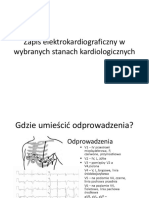 Zapis Ekg PDF