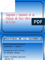 Fracturas mandibulares: clasificación, signos, síntomas y tratamiento