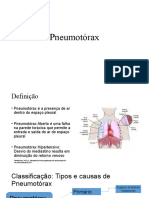 Pneumotórax Slaid