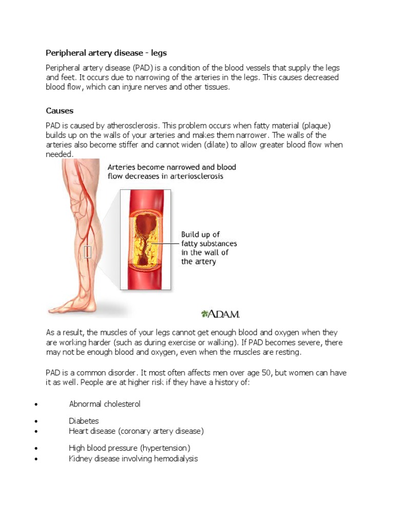 Understanding Peripheral Artery Disease | PDF | Coronary Artery Disease ...