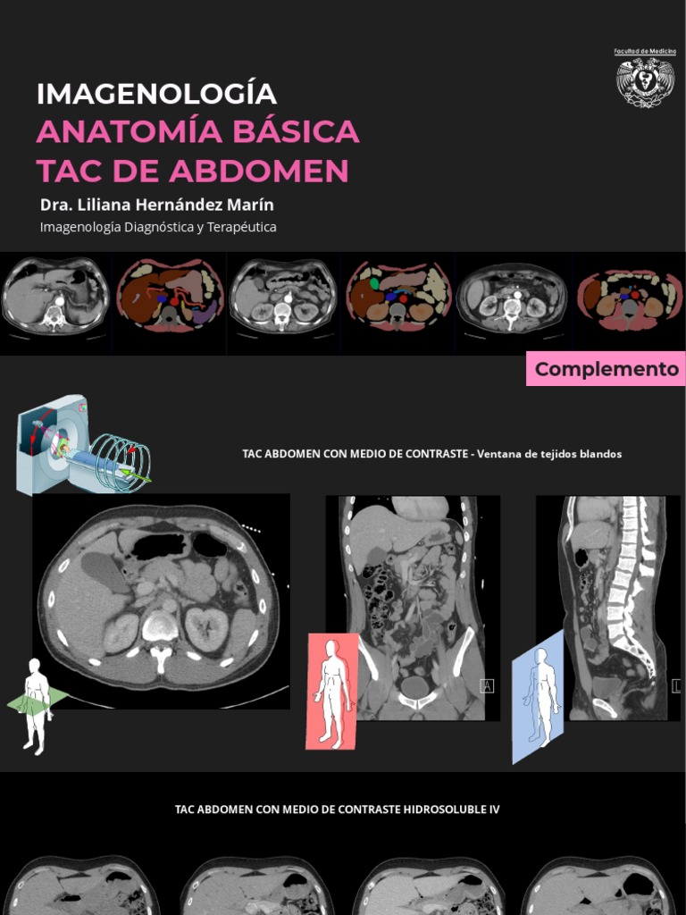 anatom-a-del-abdomen-por-tc