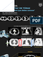 Tac de Tórax