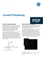 12-Lead ST Monitoring: GE Healthcare Quick Guide