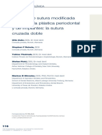 Técnica de Sutura Modificada para Cirugía Plástica Periodontal y de Implantes: La Sutura Cruzada Doble