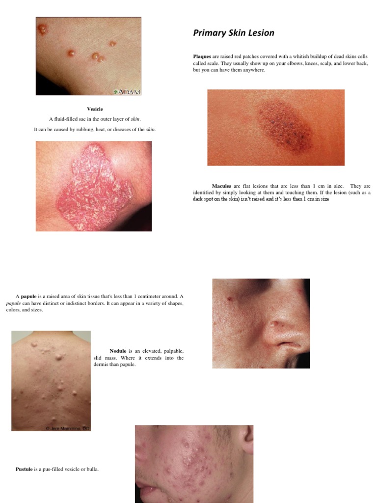 Classification and Descriptions of Primary and Secondary Skin