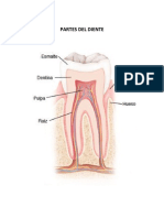 Caries